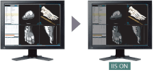 Independent Image Setting (IIS)