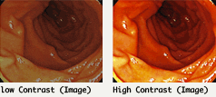 Outstanding Contrast Ratio