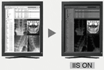 Independent Image Setting (IIS)